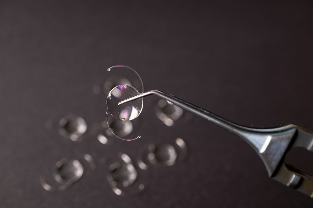 lens types for lens exchange